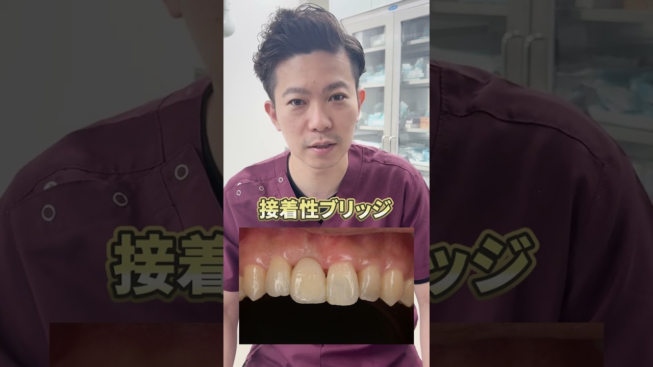 【保険治療】歯を1本失った際、保険でできる歯をほぼ削らない治療法!