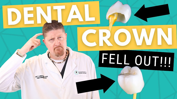 What to Do If Your DENTAL CROWN Falls Out | Dr. Brett Langston