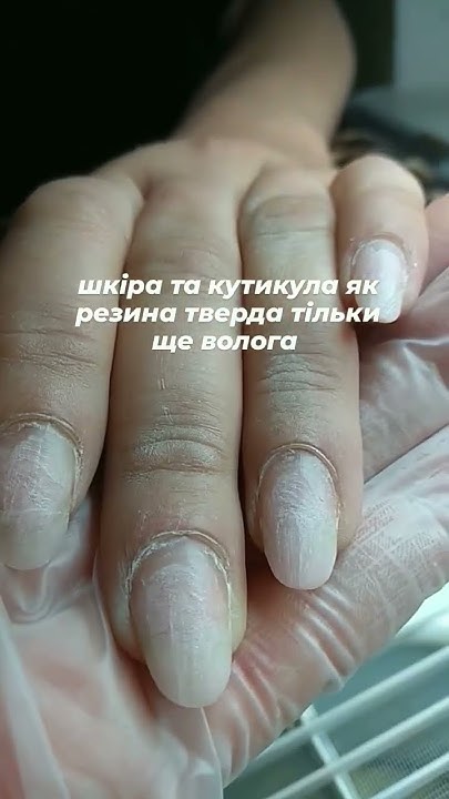 тверда кутикула - YouTube