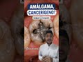 🚨ALERTA🚨 É cancerígeno ou não? #dicas #react #dentista #saude #viral