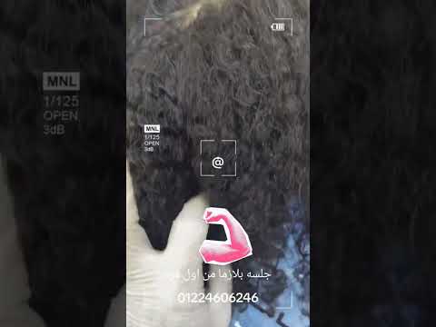 جلسه بلازما لمعالجه الشعر من الهيشان والتقسيط والسقوط بفرد بنسبه 100 01224606246