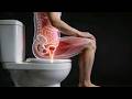 Vous êtes assis sur vos toilettes de la mauvaise façon (voici pourquoi)