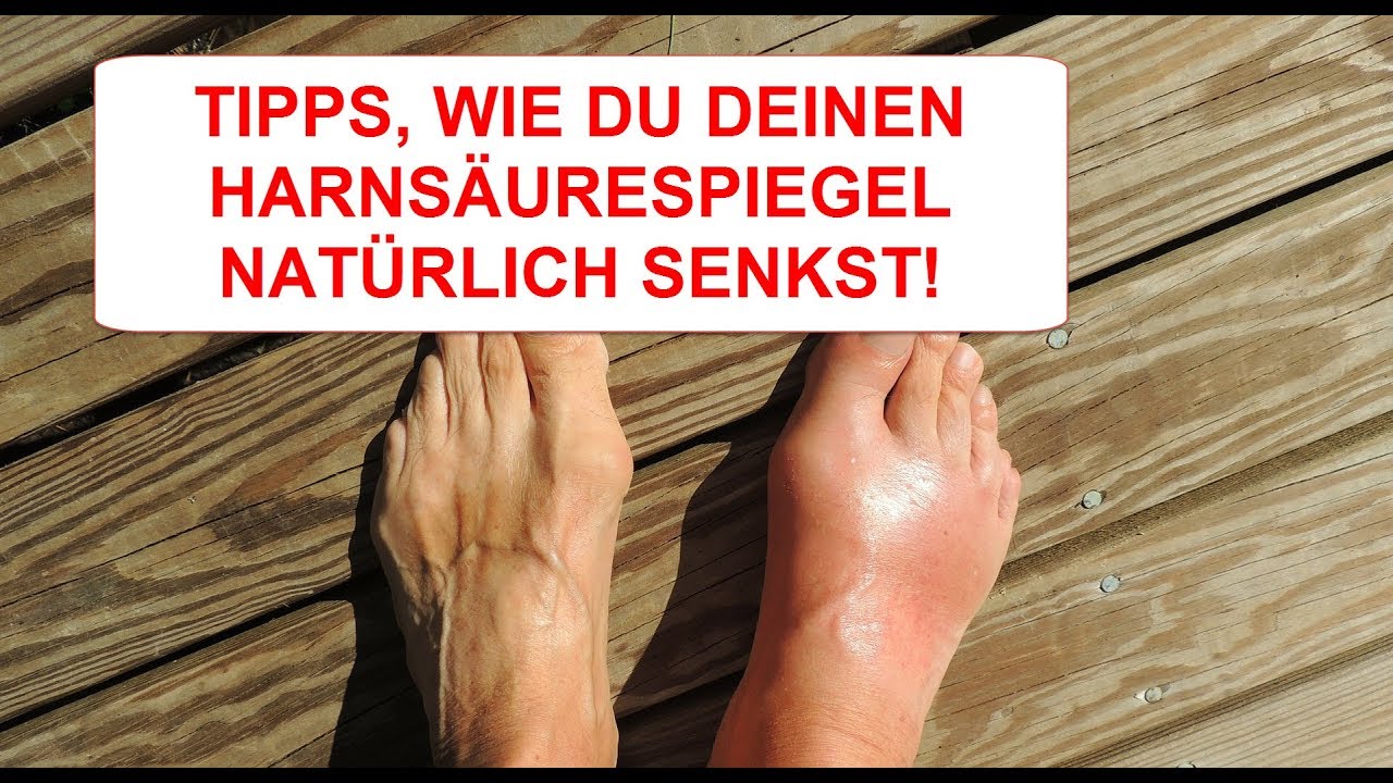 Wie Kann Man Harnsäure Senken www.youtube.com