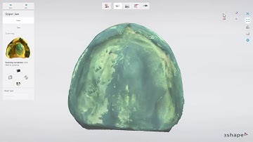 3DBioCAD - 3Shape Dental System Single Full Denture Scanning Workflow