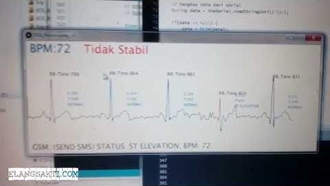 Arduino Monitoring & Analisis Detak Jantung ECG/EKG secara Realtime dengan Sensor AD8232