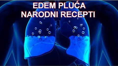 VODA U PLUĆIMA - 5 Narodnih Efikasnih Recepata!