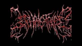 Cephalotripsy - Excavation Of Encystation