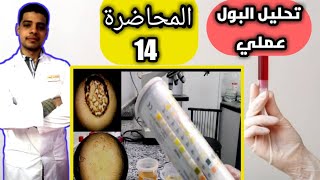 تحليل البول الكامل عملي   complete urine analysis