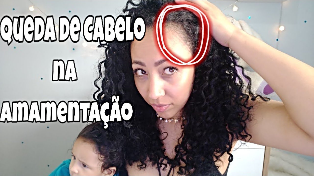 Queda De Cabelo Na Amamentação- O Que Fazer- melhor Que ImecapHair ...
