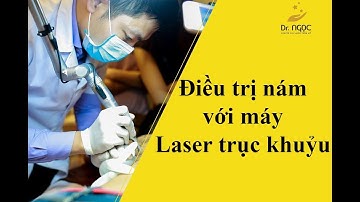 Điều trị nám với máy laser Yag trục khuỷu | Dr ngoc