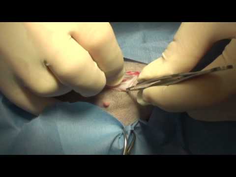 Videó: A női kutyád megterhelése: Sebészeti eljárás GYIK