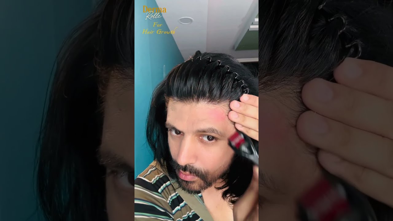 How To Use Derma Roller For Hair Growth Dermaroller Hairgrowth Haircare
