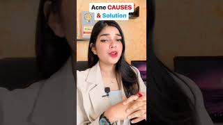 What is the Causes behind ACNE Prone Skin..