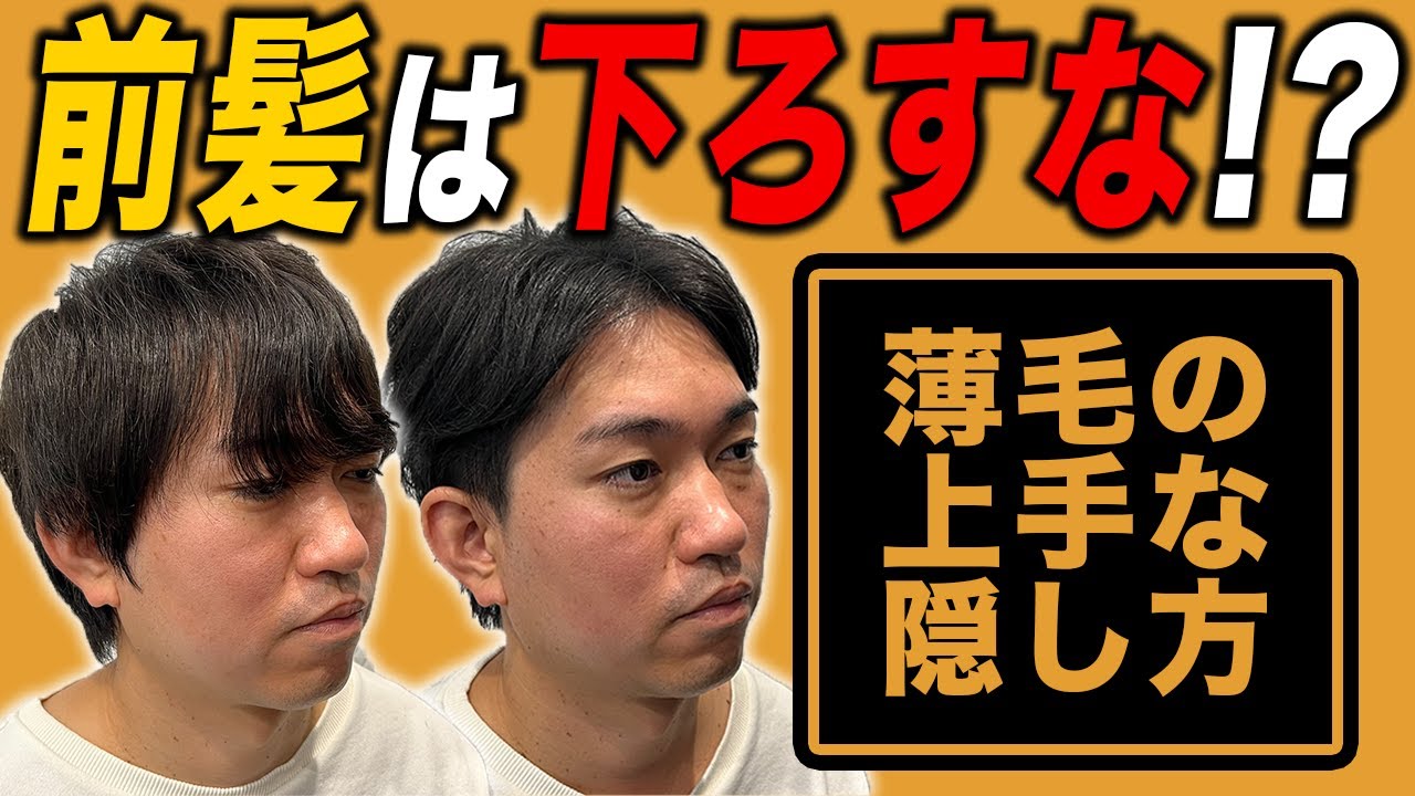 薄毛ヘアスタイル M字ハゲ 頭頂部をヘアカットでカバーする方法 Youtube