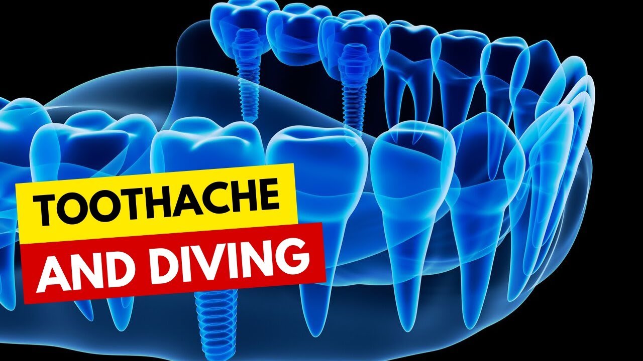 Toothache and Diving YouTube