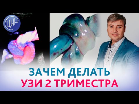 Ультразвуковой скрининг 2 триместра. Когда и с какой целью делается скрининг 2 триместра.