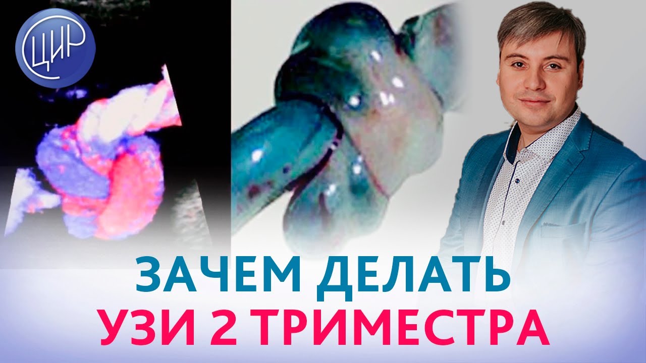 Ультразвуковой скрининг 2 триместра. Когда и с какой целью делается ...