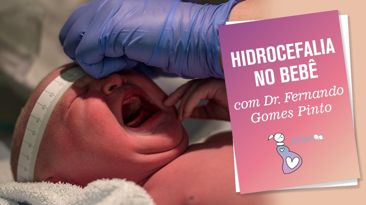 HIDROCEFALIA NO BEBÊ