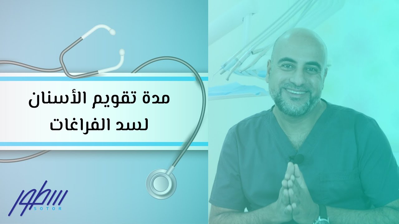 مدة تقويم الأسنان لسد الفراغات Youtube