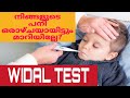 Widal test  typhoid fevermalayalam