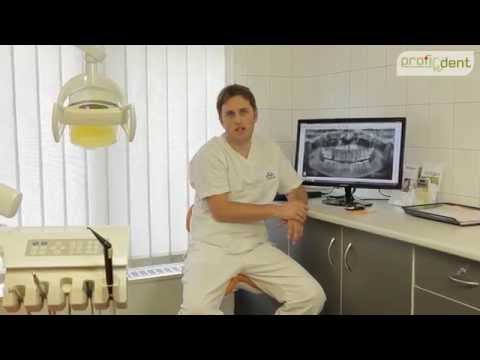 Videó: A Modell Emlőplasztikai Műtétet Végzett A Fogorvosnál, és Megmutatta Az 
