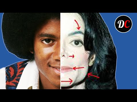 Wideo: Dlaczego Michael Jackson Zmienił Kolor Skóry