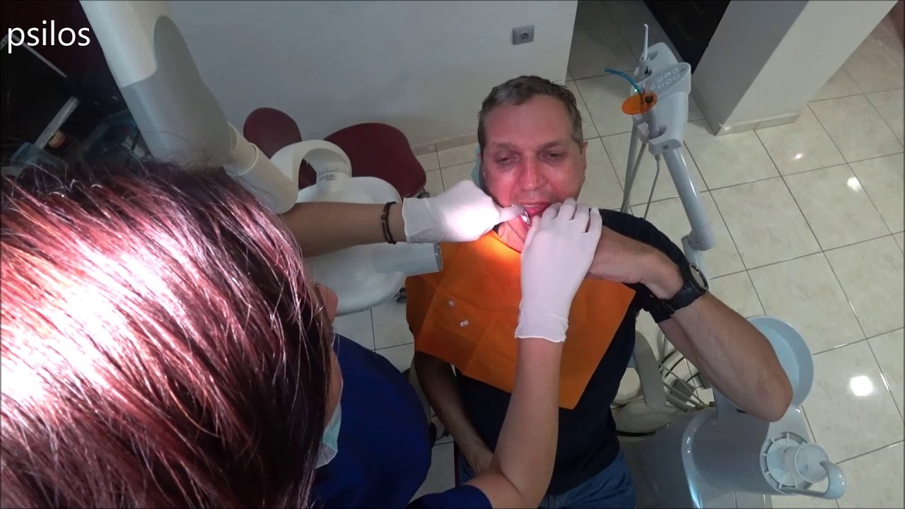 Root canal treatment - Dentist