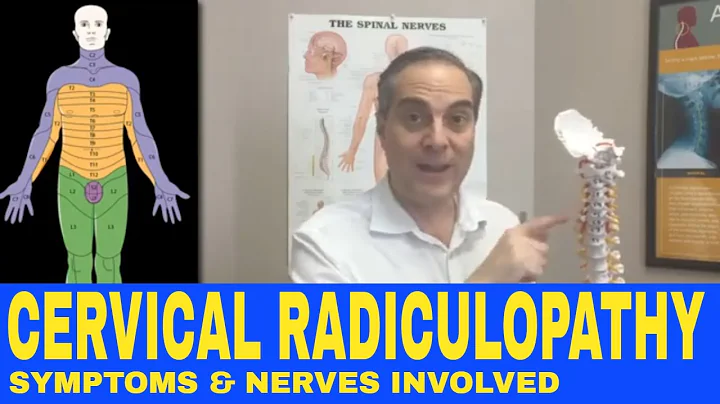 Cervical Radiculopathy Symptoms, Nerve Chart, Nerve Distribution | Dr. Walter Salubro