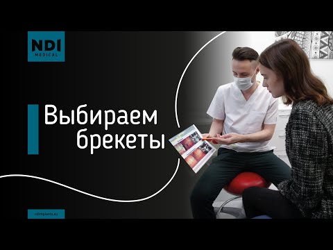 Какие брекеты бывают? ТОП брекет систем. Виды брекетов.