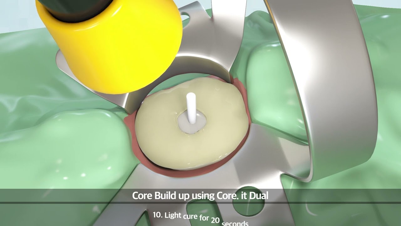 [SPIDENT] Core.it dual (영문/English)