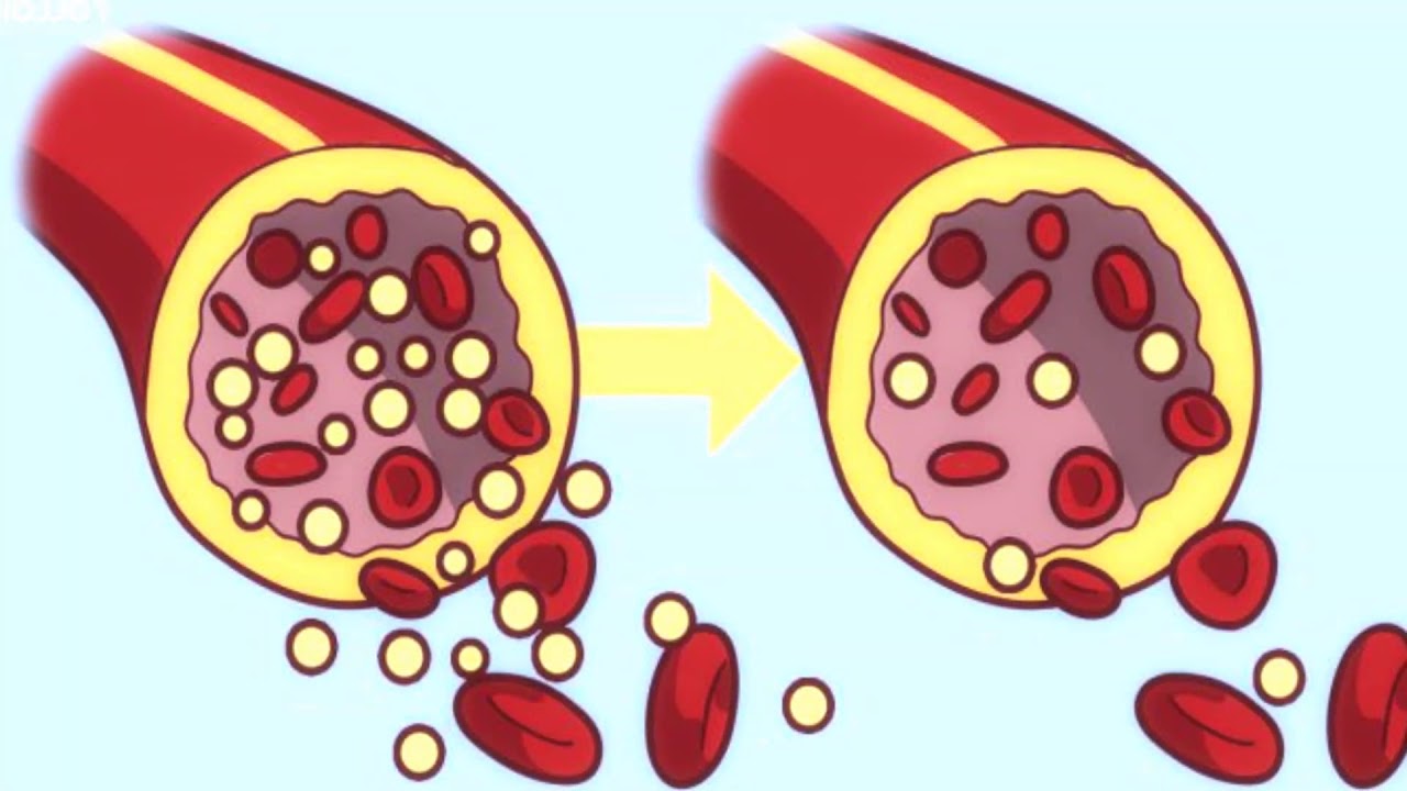 Azúcar en sangre después de comer