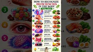 8 Signs Your Body May Be Lacking Important Nutrients ⚠️