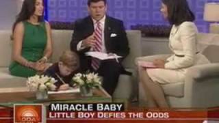 Bret Baier Shares Story of His Baby's Heart on Today