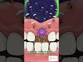 What’s REALLY hiding under your nails #viral #dentist #shorts  #funny #smiledesigndental #animation