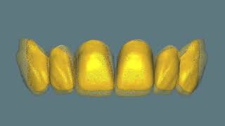 Exocad tooth library