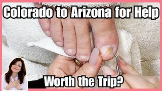 How to Help Painful Toenails at Home