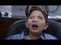 Amazing Cleft face Transformation Surgery for a Boy