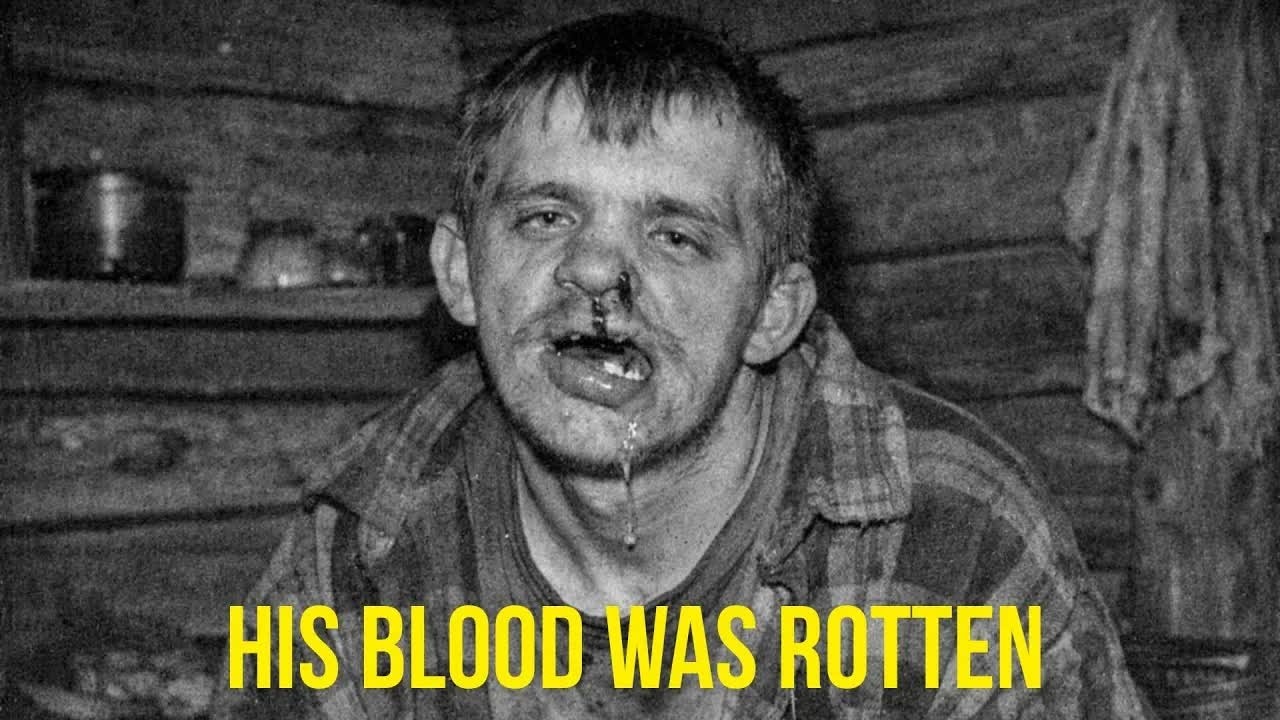 The Father Who Carried Rot in His Blood: The Appalachian Lineage That Never Stopped Dying