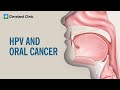 What Is HPV-Related Oral Cancer?