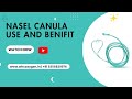 Nasal Cannulae in Oxygen Therapy: Uses, Benefits, and Method of Use