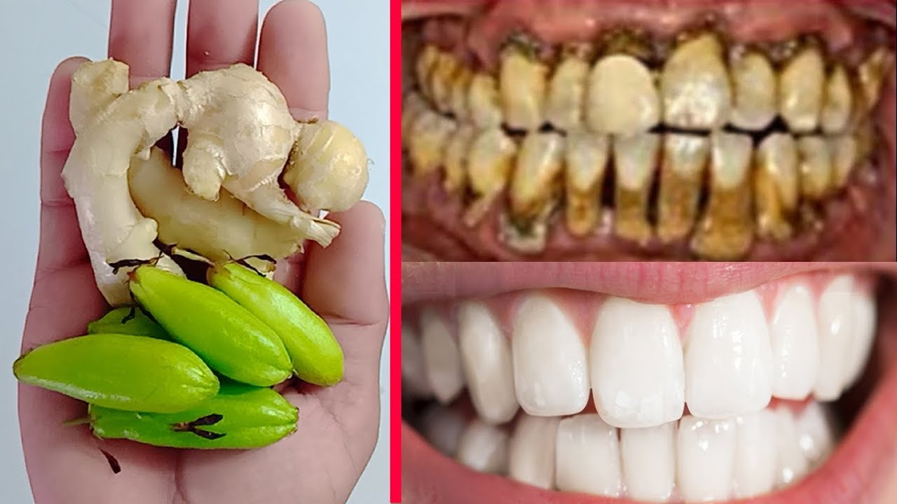 Dirty Yellow Teeth To White Permanently in Just 7 days Naturally | 100% ...