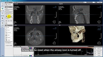 Xelis Dental Case Tutorial Airway
