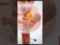 3D Fetal Anatomy Early Pregnancy Visualization Pregnancy Earlypregnancy Unbornbaby Shorts 