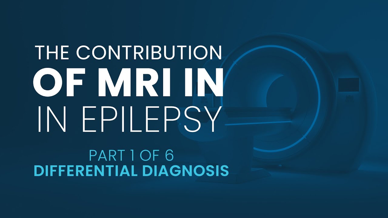 The contribution of MRI in Epilepsy | Part 1 Differential Diagnosis