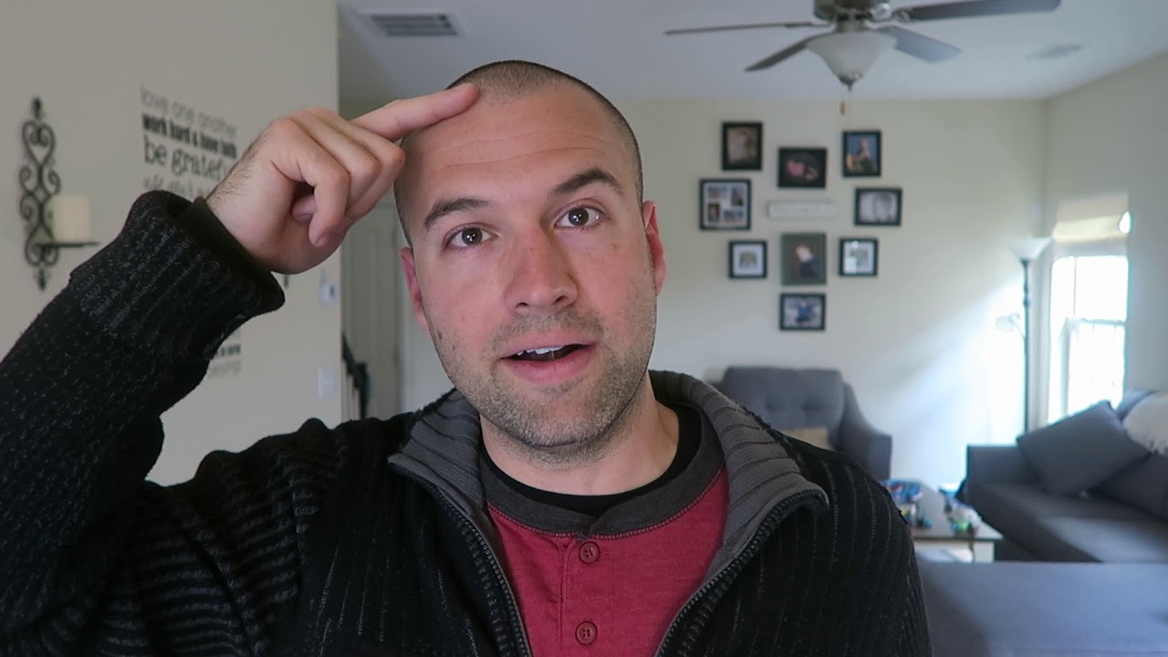 A Receding Hairline Must Be More Difficult If You are Transgender?