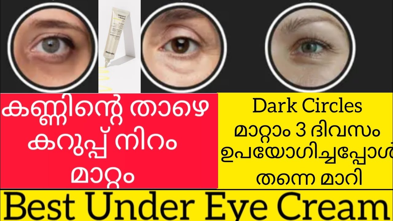 Best Under Eye Cream| Dark Circles |  Beauty Care Tips | Minimalist Under Eye Cream