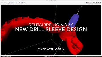 Dental3DPlugin 3.2.0 - New Drill Sleeve Design