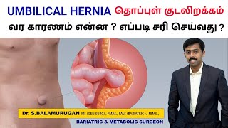 Umbilical Hernia Causes & Treatment தபபள கடலறககம வர கரணம எனன ? எபபட சர சயவத ?