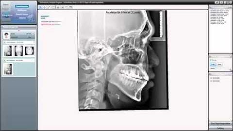 14  An Introduction to Superimposition Tutorial Video For OrthoVision