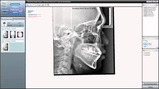 14  An Introduction to Superimposition Tutorial Video For OrthoVision Net Worth
